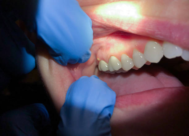 Best Emergency TMJ Treatment in Baxter Estates, NY