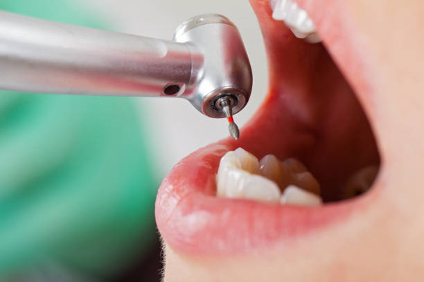 Best Pediatric Emergency Dentist in Baxter Estates, NY